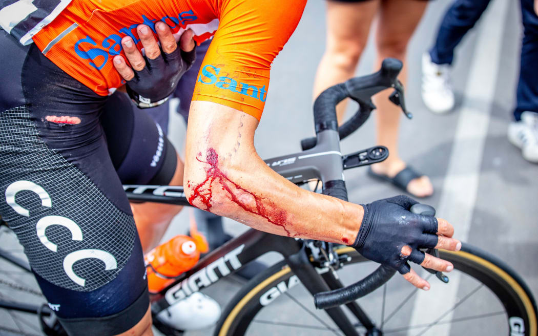 Patrick Bevin after his crash in Tour Down Under 2019.