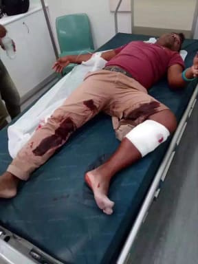 Injured Bangladeshi asylum seeker is hospitalised