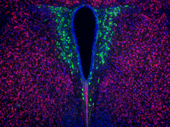 Researchers showed that while the number of oxytocinergic cells (green) are reduced in the brains of maternal high-fat diet offspring, treatment with Lactobacillus reuteri increases their number.