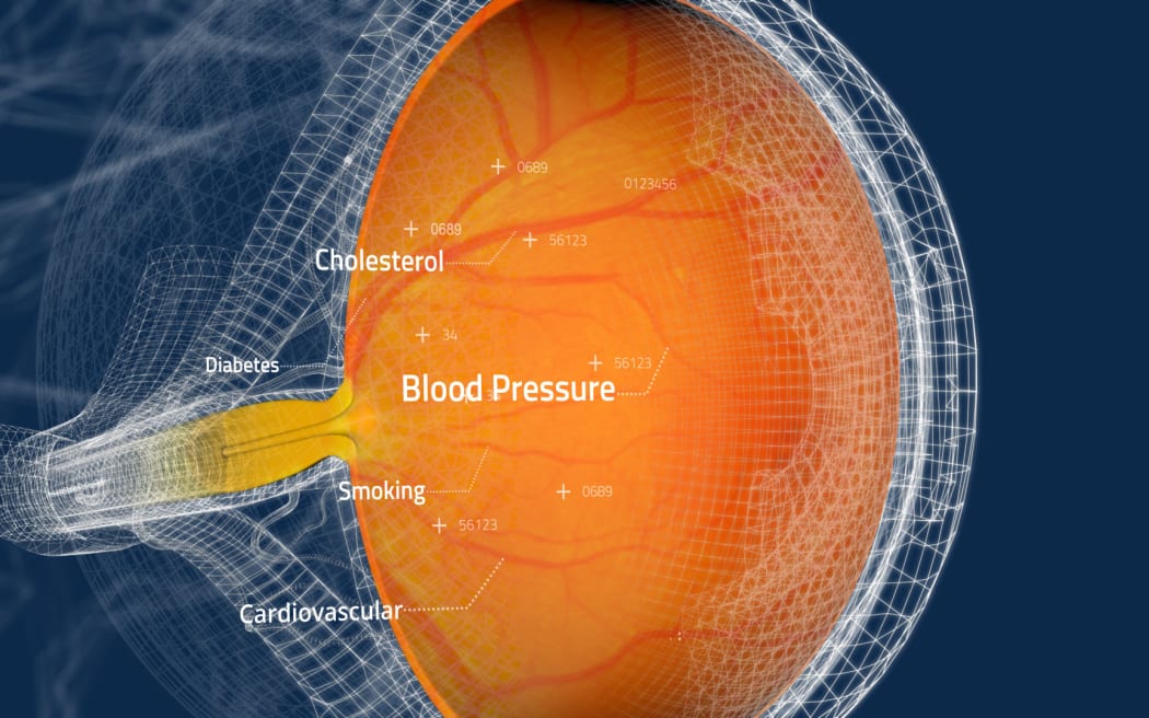 A retina scan.