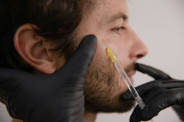 A young bearded man receives an injection in his crow's feet.