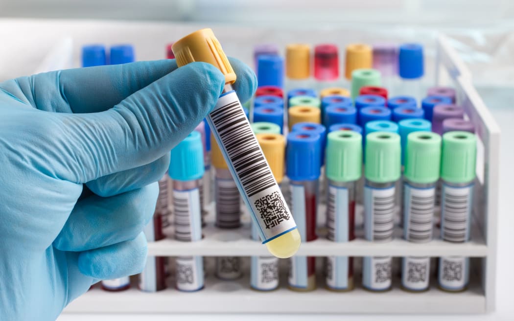 A lab technician holding blood tube test.