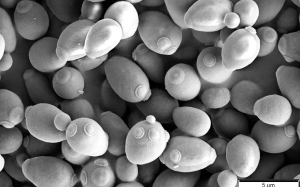 Brewer's yeast