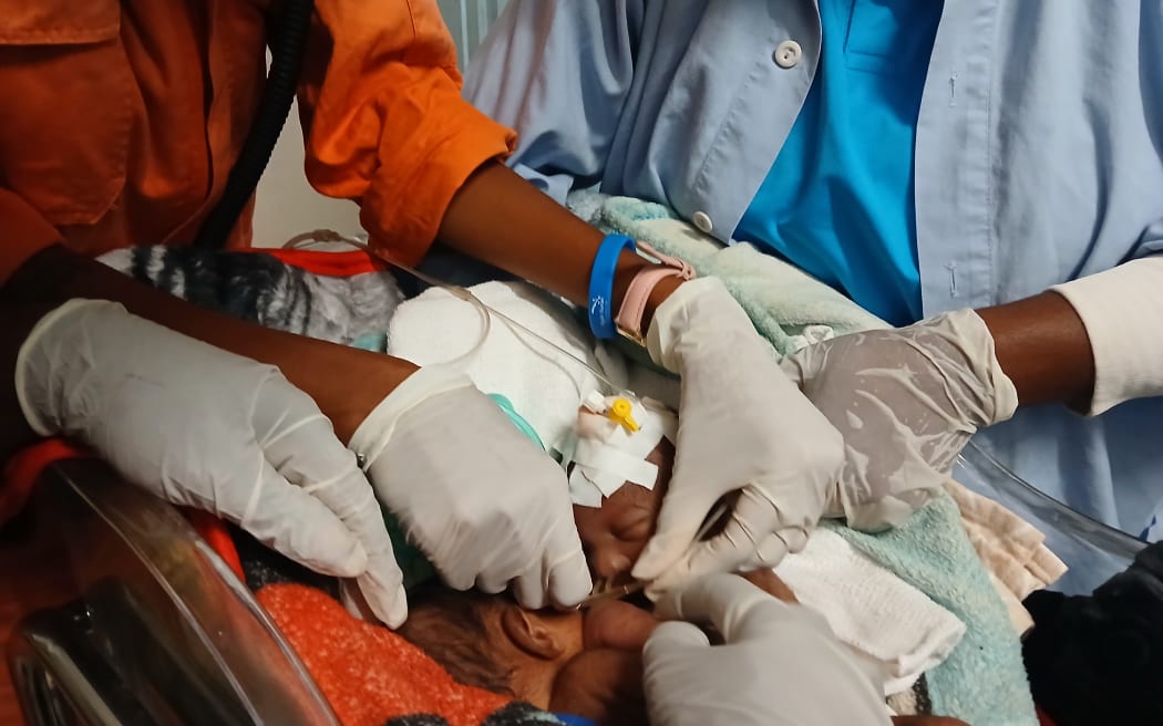 The twin boys are joined at the lower portion of their bodies and share some organs.