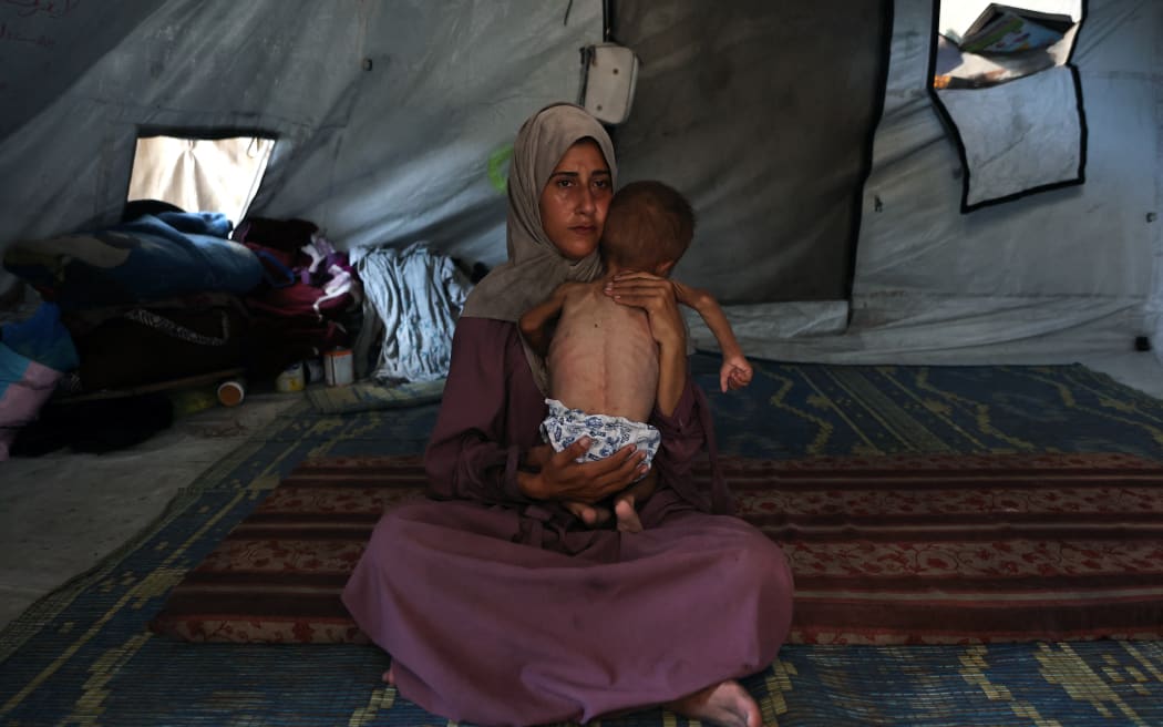 Hidaya, a 31-year-old Palestinian mother, cradles her sick 18-month-old son Mohammed al-Mutawaq, who is also displaying signs of malnutrition, inside their tent at the Al-Shati refugee camp, west of Gaza City, on July 24, 2025. More than 100 aid organisations and human rights groups warned on July 23, that "mass starvation" was spreading in Gaza, as the United States said its top envoy was heading to Europe for talks on a possible ceasefire and aid corridor. (Photo by Omar AL-QATTAA / AFP)