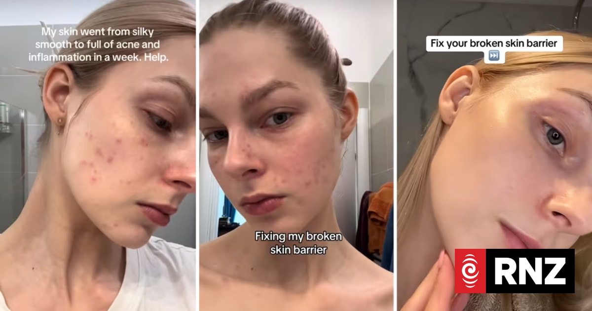 The ‘glass skin’ Korean beauty trend has risks, experts warn