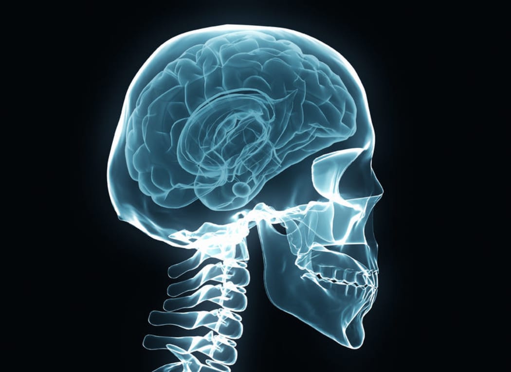 X-ray of a human skull, brain and spine