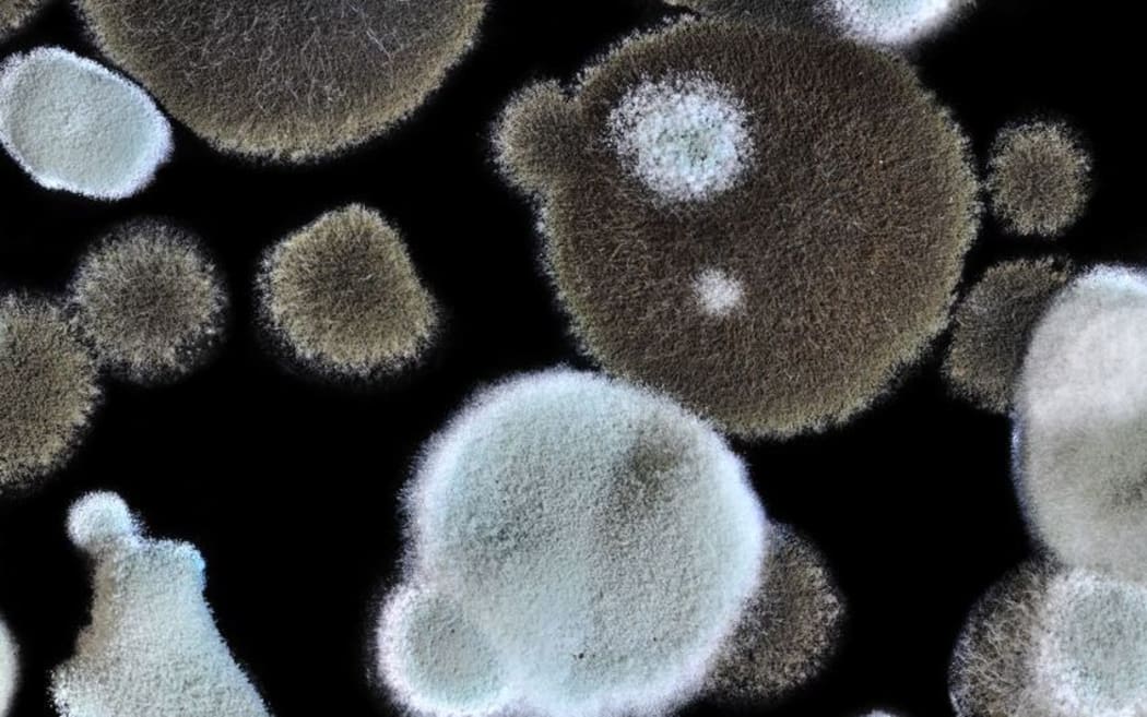 At least 11 employees have reported symptoms linked to toxic mould found in the council buildings.