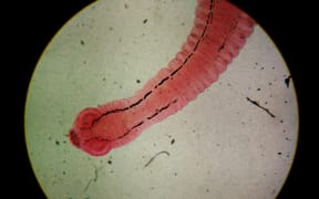 Close-up egg with adult parasite found with microscope in parasitology.