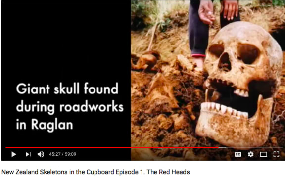 A still from the documentary Skeleton in the Cupboard