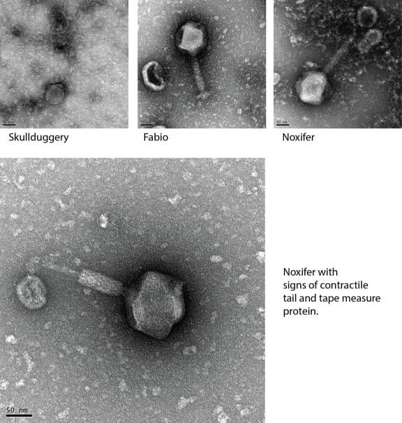 Meet Skullduggery, Fabio and Noxifer, the jumbo phages discovered during the Hendrickson lab's phage hunt.