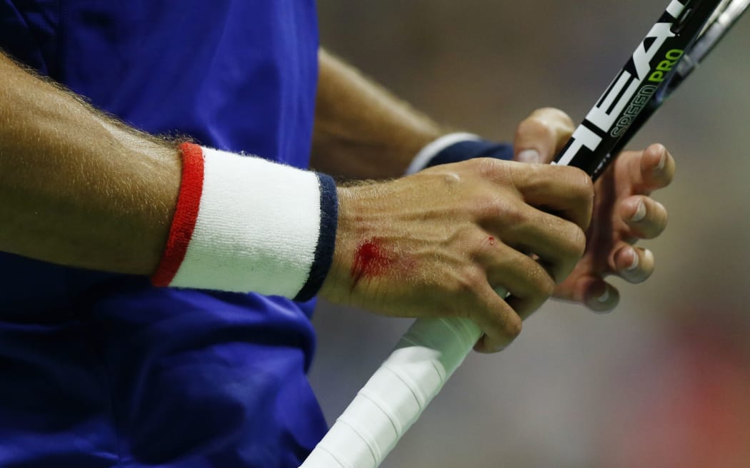 Novak Djokovic holds his racquet with blood on his wrist in his match against Roger Federer in the US Open 2015 men's final AFP PHOTO/KENA BETANCUR