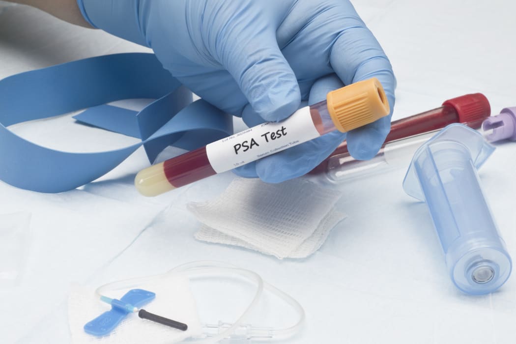 A test tube for a prostate cancer antigen next to a catheter and a blue ribbon (file photo)