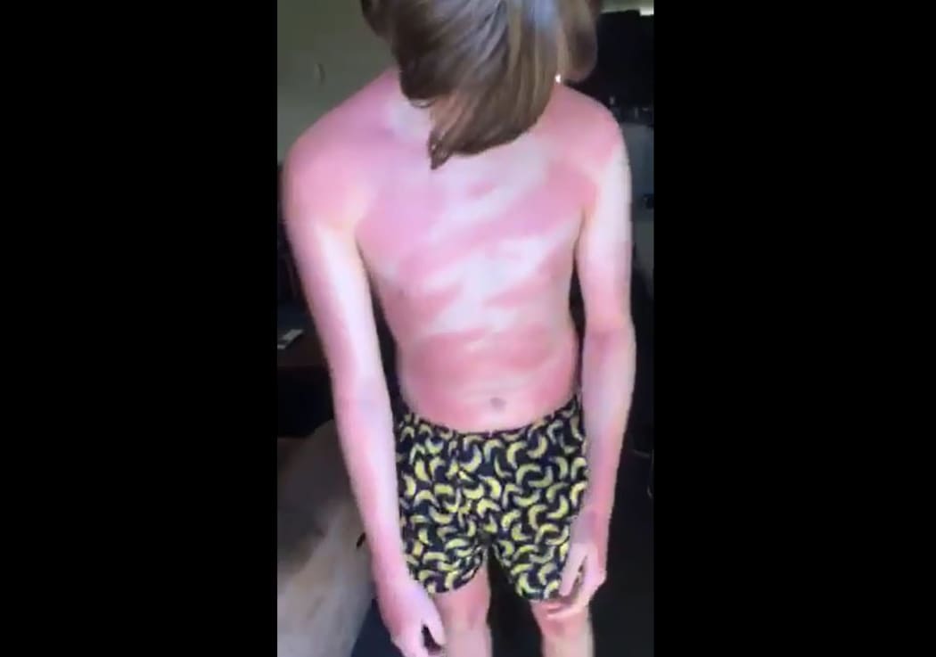 Margaret has complained to Cancer Society after her son still got burnt after using one of their sunscreen products.