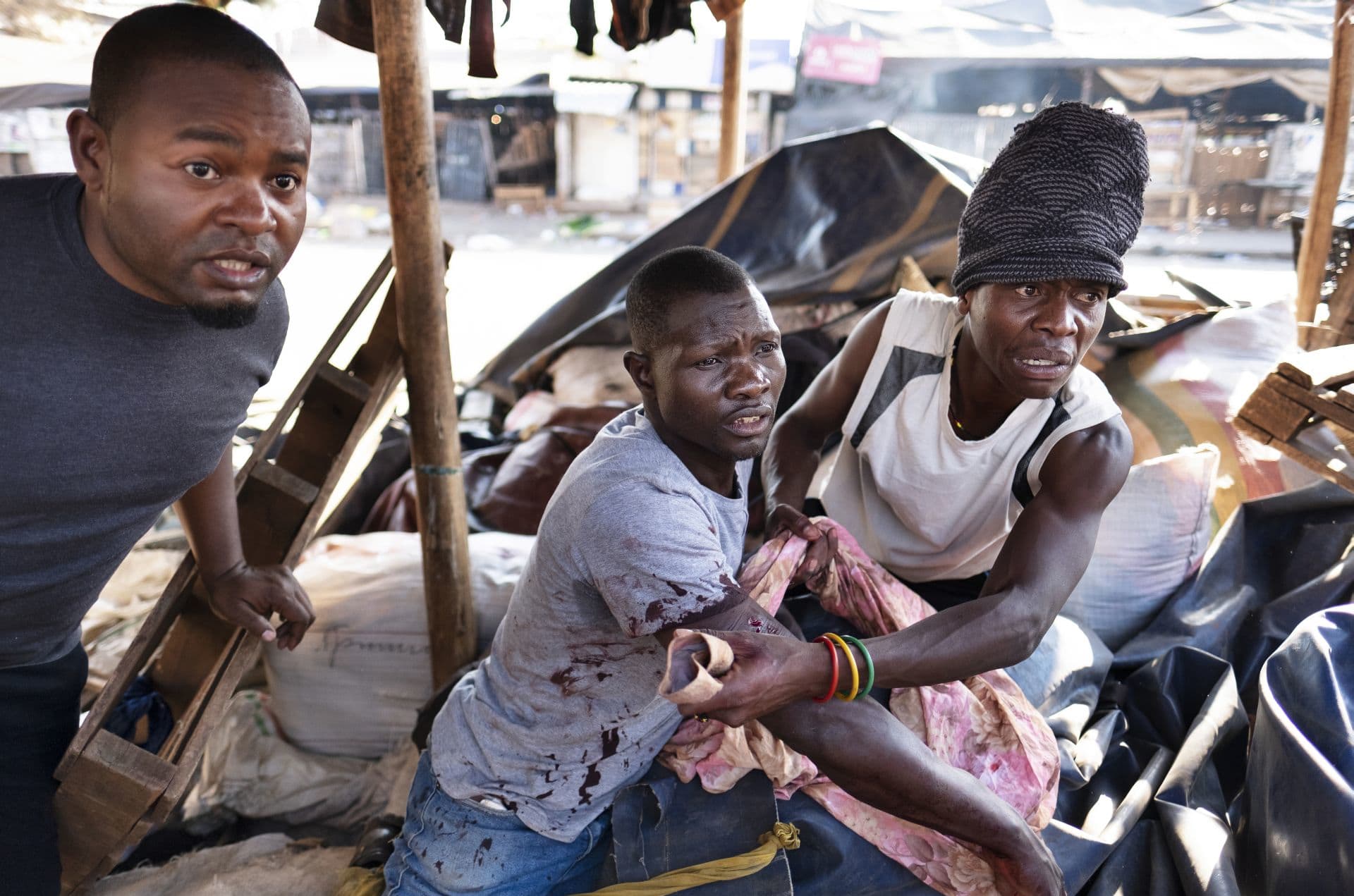 A wounded man takes shelter in a market stall in Harare as protests turned violent.