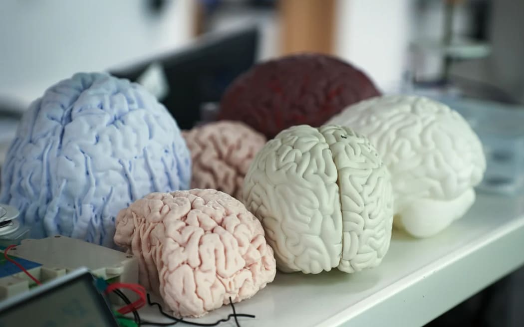Brain models on display inside the lab of CIBR in Beijing, China on May 28, 2025.