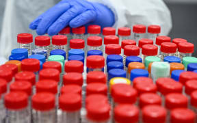 A laboratory staff wearing Personal Protective Equipments (PPE) places a hand on samples collected for Covid-19 coronavirus testing.