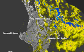 Rain radar