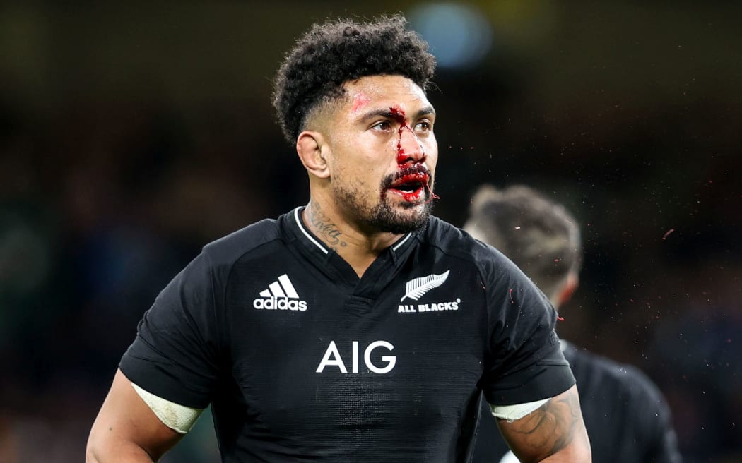 New Zealand's Ardie Savea with a blood injury