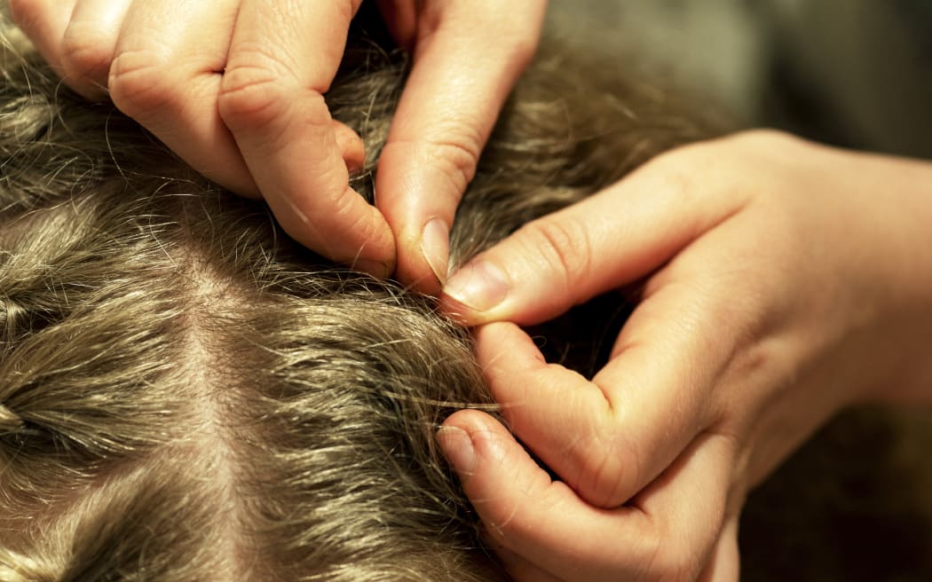 Head lice on a girl's head with woman's hands pressing to get rid of louse.