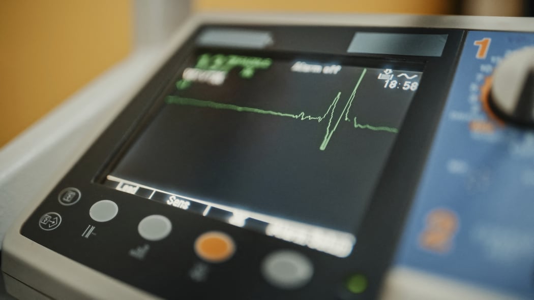 Vital signs monitor showing heart rate. (Photo by GORODENKOFF PRODUCTIONS/SCIENCE / GPR / Science Photo Library via AFP)