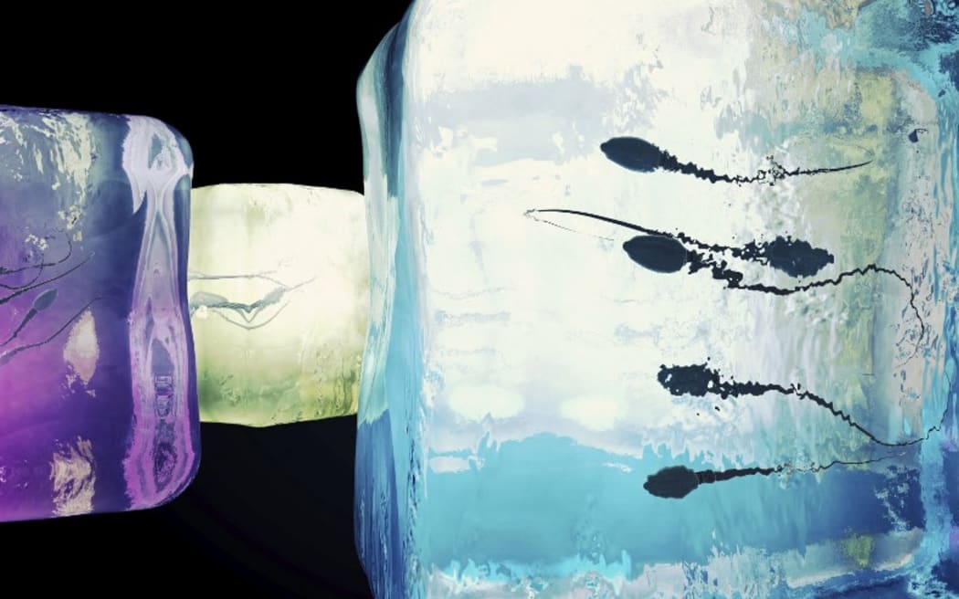Cryonic preservation of sperm, conceptual illustration. (Photo by CHRISTOPH BURGSTEDT/SCIENCE PHOT / CBR / Science Photo Library via AFP)