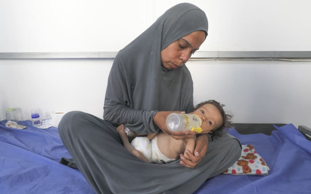Six-month-old Jouri Abu Hajar lies in the nutrition ward at Al-Awda Hospital in Nuseirat, central Gaza, on July 22, 2025. Suffering from chronic illness and severe malnutrition, Jouri is one of many children at risk amid a catastrophic shortage of food and medicine caused by the ongoing war and blockade on Gaza.
