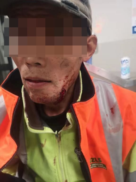 Renkun Li after the attack.
