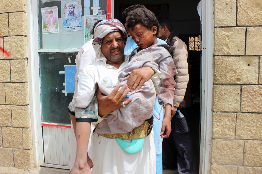 A man transports a child to a hospital after he was wounded in a reported air strike on the rebels' stronghold province of Saada.