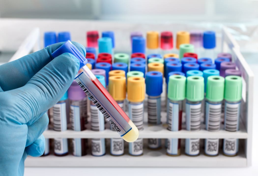 Lab worker, laboratory, blood test tube.