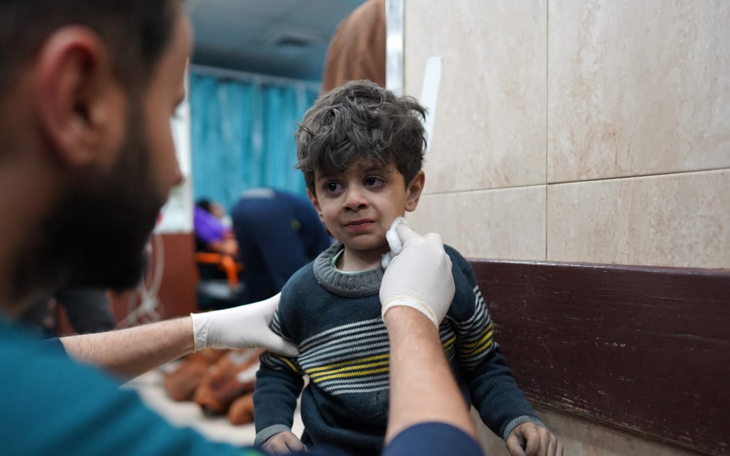A Palestinian child receives medical attention at the Al-Aqsa Martyrs Hospital in Deir al-Balah on March 19, 2024, following Israeli bombardment in the Nuseirat refugee camp in the central Gaza Strip, amid ongoing battles between Israel and the militant group Hamas. (Photo by AFP)