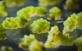 Clusters of blueberry cells.
