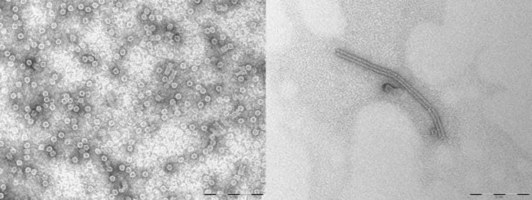 Two electron microscope images showing rings (left) and rings stacked to form a tube (right)