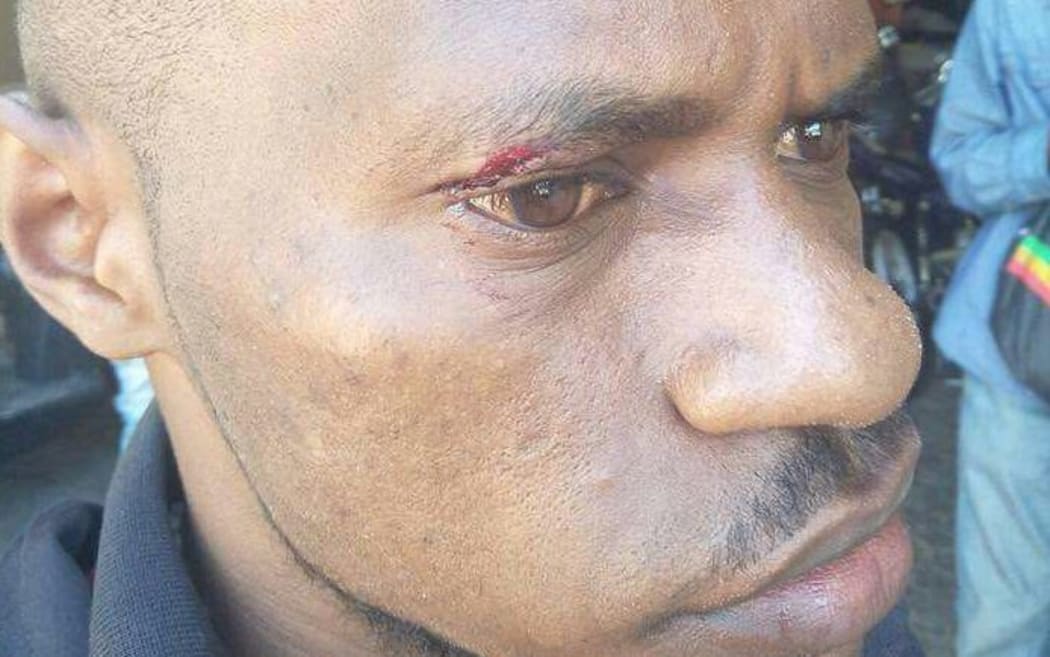 West Papuan protestor who claims he was assaulted in Malang protest, 15 August 2017.