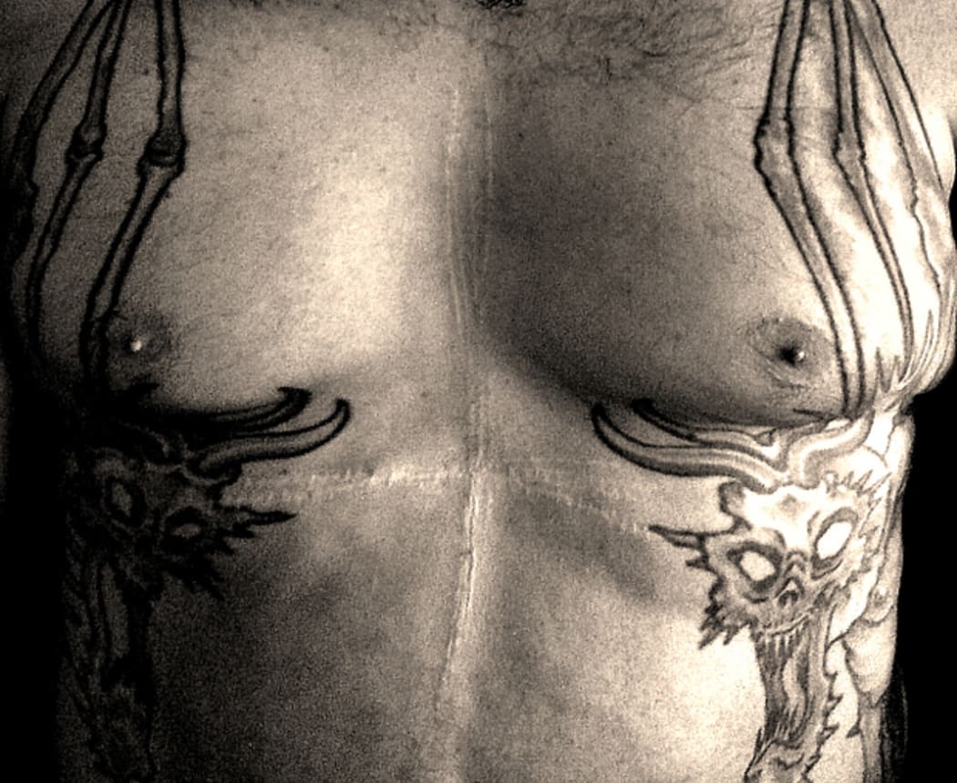 Skuldom's Faeces Christ and his onstage injuries.