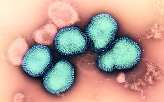 Influenza a virus (h3n2) 
Influenza A Virus (H3N2). Credit: NIAID/NIH A clinical trial of an experimental universal influenza vaccine developed by researchers at the National Institute of Allergy and Infectious Diseases? (NIAID) Vaccine Research Center (VRC), part of the National Institutes of Health, has begun enrolling volunteers at Duke University in Durham, North Carolina. This Phase 1 trial will test the experimental vaccine, known as H1ssF-3928 mRNA-LNP, for safety and its ability to induce an immune response. Read more:. (Photo by NIH-NIAID / IMAGE POINT FR / BSIP via AFP)