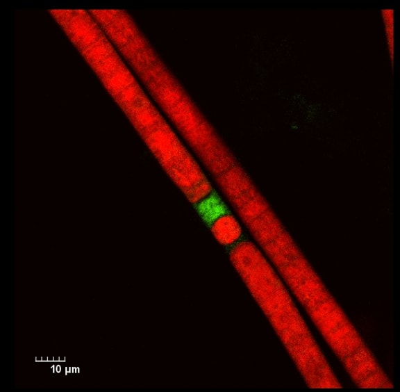 Cyanobacteria seen under a fluorescence microsope.