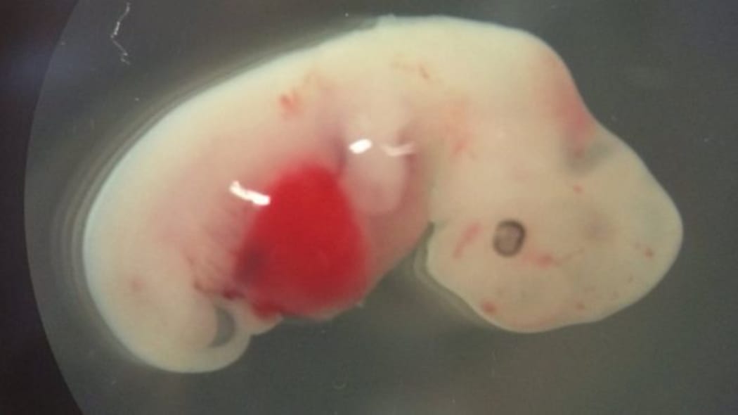 To create a chimera, human stem cells are injected into a pig embryo.