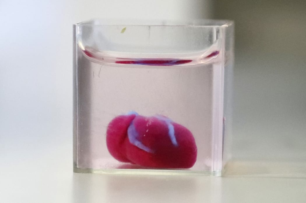 This photo from the University of Tel Aviv shows a 3D print out of a heart with human tissue.