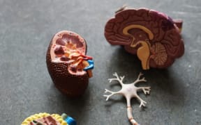Brain model