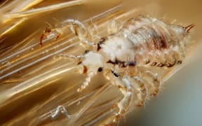 male louse on human hair