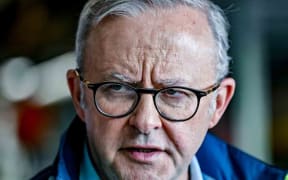 Anthony Albanese says the US tariffs are not a friendly act.