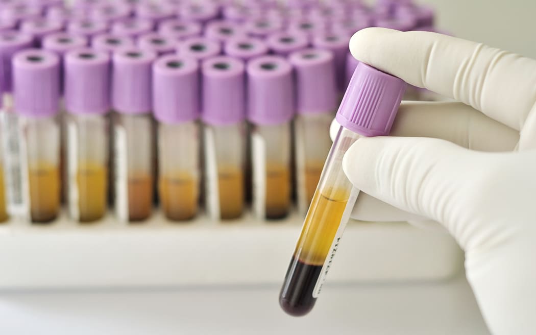 blood tests