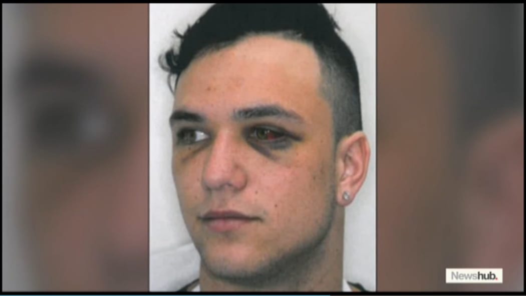 Newshub airs a Police photo of injuries sustained by one of Losi Filipo's four victims.
