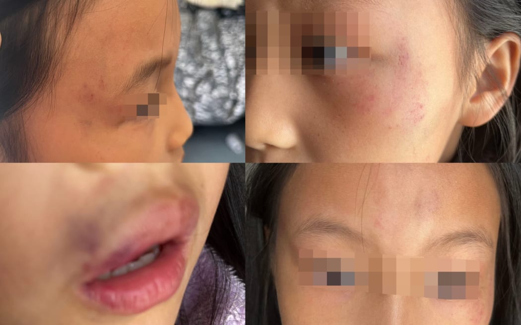 A nine-year-old who was attacked in a bathroom in the Crowne Plaza in central Auckland on 7 August, 2024.