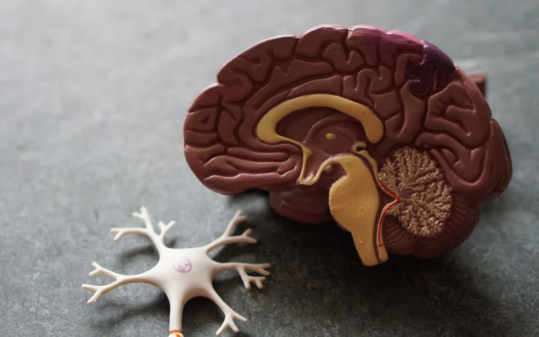 Plastic model of a human brain