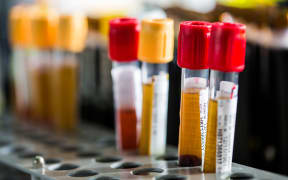 Blood samples with Hepatitis B and C viruses in a hospital in France