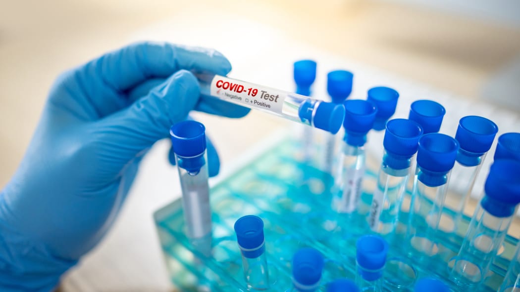 Medical scientist hand with blue sterile rubber gloves holding COVID-19 test tube in hospital laboratory.