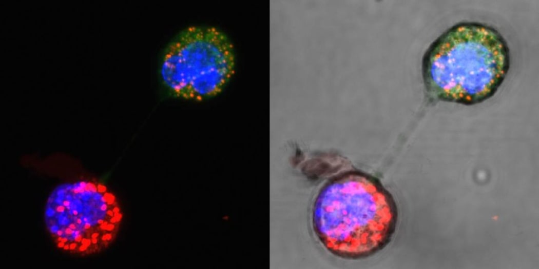 These images show the transfer of mitochondria, via a nanotube, between breast cancer cells in a mouse.