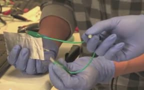 Scientists have developed a fast-charging aluminium battery.